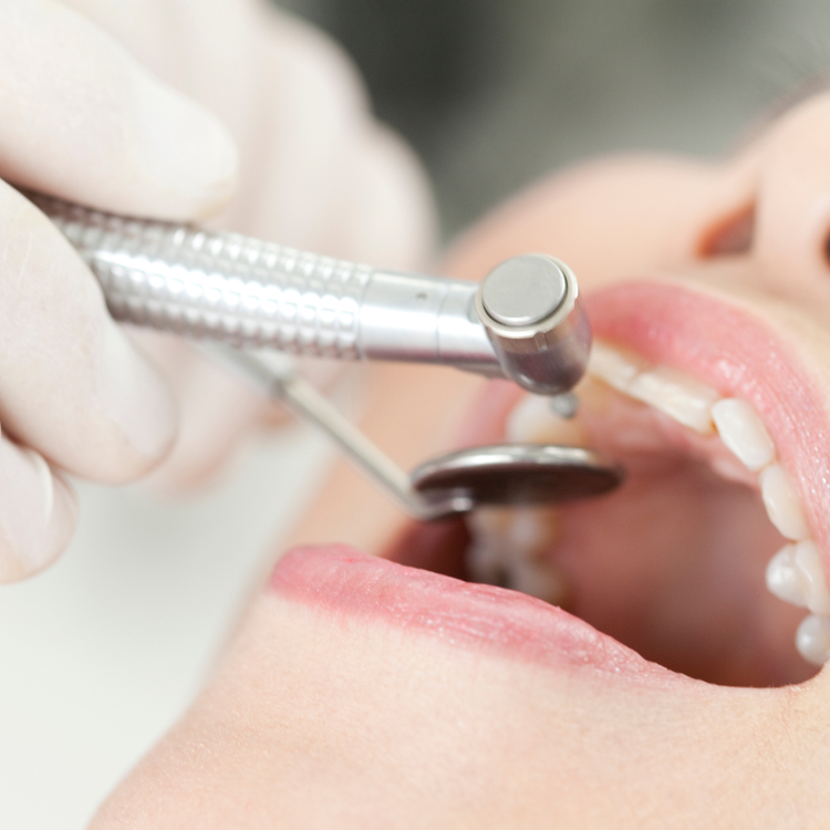 矯正治療後のフォロー