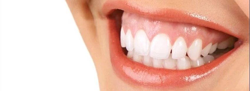 笑った時の歯茎が気になる