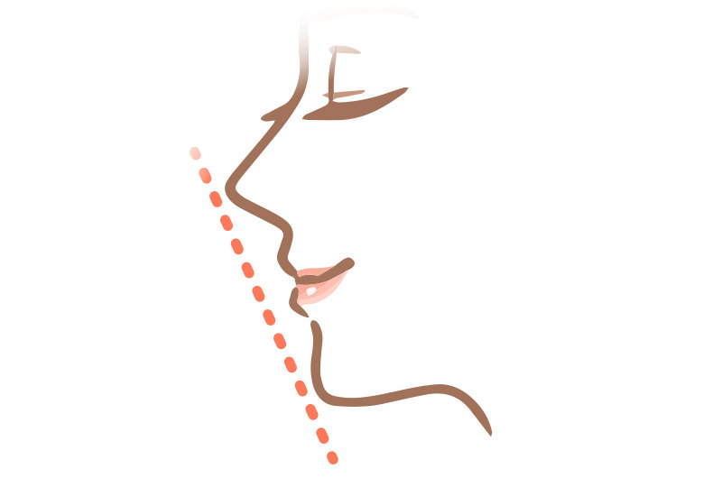 Eラインが気になるとはどんな状態？